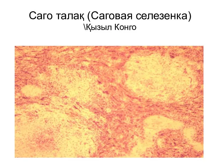 Саго талақ (Саговая селезенка) \Қызыл Конго