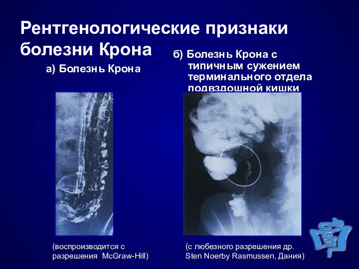 (воспроизводится с разрешения McGraw-Hill) (с любезного разрешения др. Sten Noerby