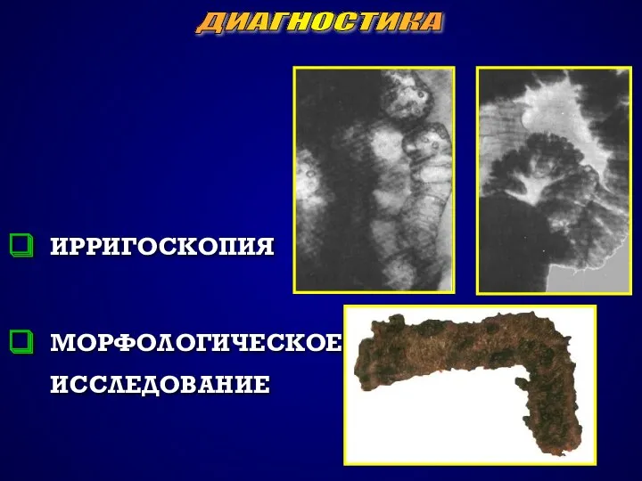 ИРРИГОСКОПИЯ МОРФОЛОГИЧЕСКОЕ ИССЛЕДОВАНИЕ ДИАГНОСТИКА