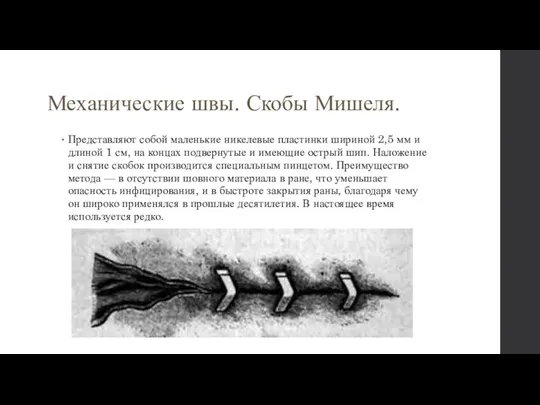 Механические швы. Скобы Мишеля. Представляют собой маленькие никелевые пластинки шириной