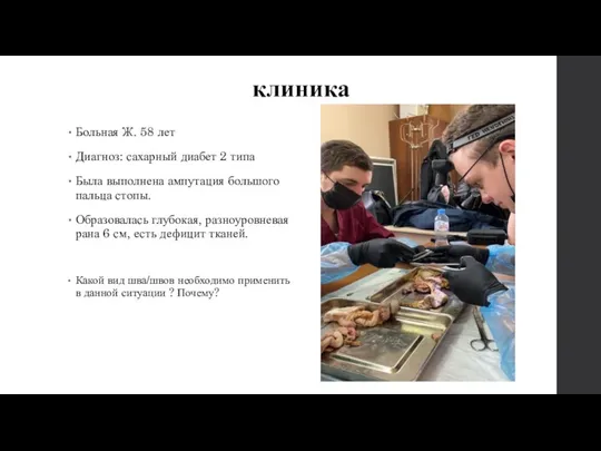 клиника Больная Ж. 58 лет Диагноз: сахарный диабет 2 типа