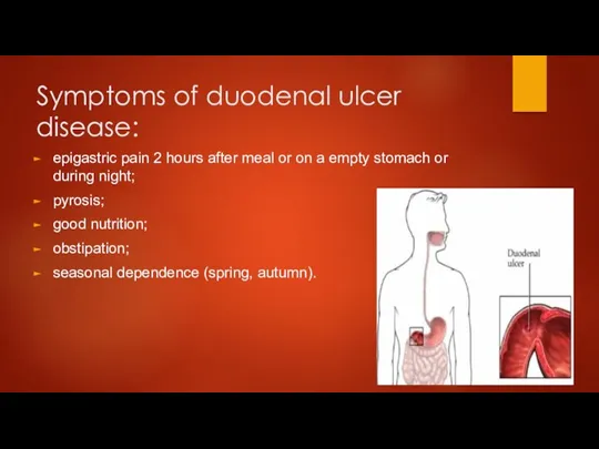Symptoms of duodenal ulcer disease: epigastric pain 2 hours after meal or on