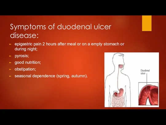 Symptoms of duodenal ulcer disease: epigastric pain 2 hours after