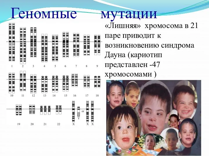 Геномные мутации «Лишняя» хромосома в 21 паре приводит к возникновению