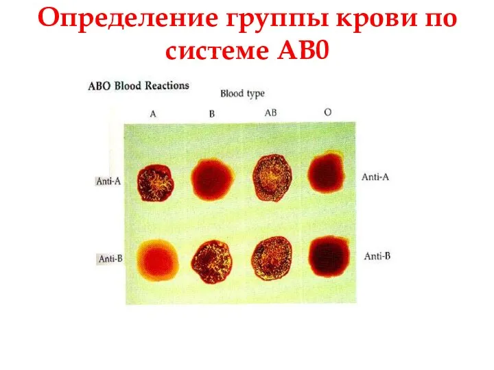 Определение группы крови по системе АВ0