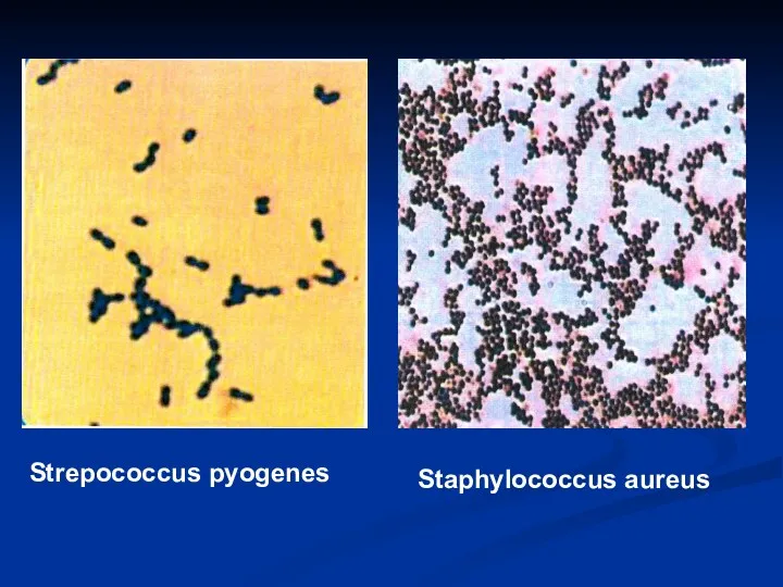 Strepococcus pyogenes StaphyIococcus aureus