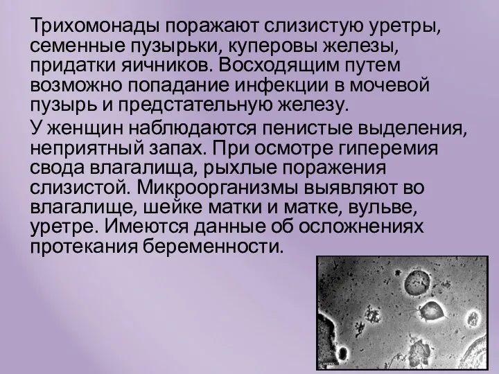 Трихомонады поражают слизистую уретры, семенные пузырьки, куперовы железы, придатки яичников.