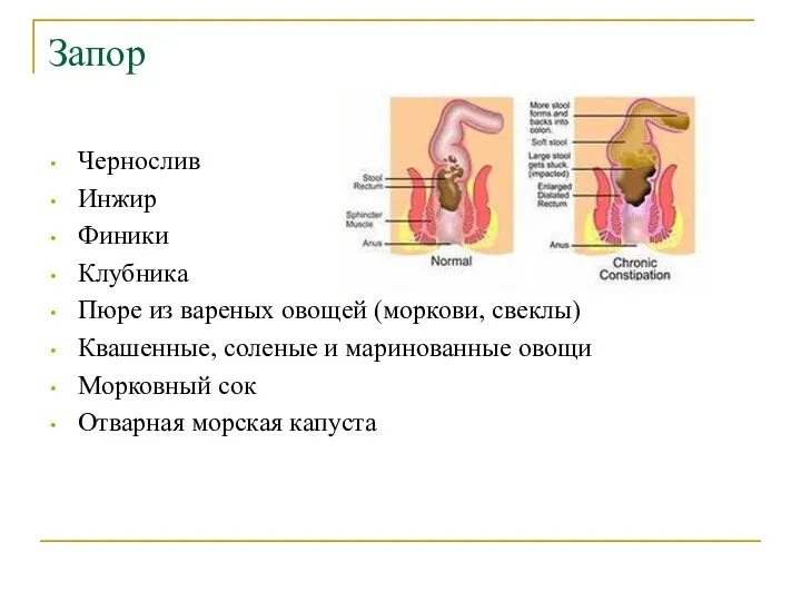 Запор Чернослив Инжир Финики Клубника Пюре из вареных овощей (моркови,