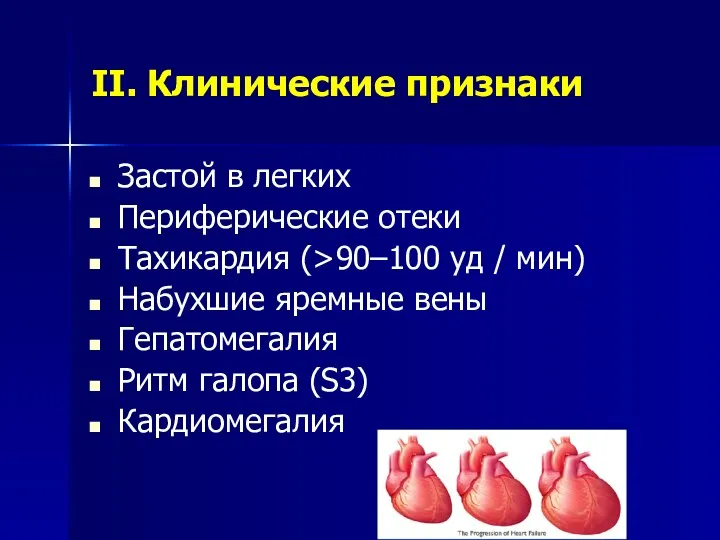 II. Клинические признаки Застой в легких Периферические отеки Тахикардия (>90–100