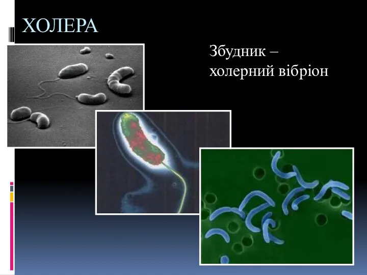 ХОЛЕРА Збудник – холерний вібріон