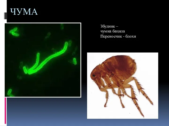 ЧУМА Збудник – чумна бацила Переносчик - блохи