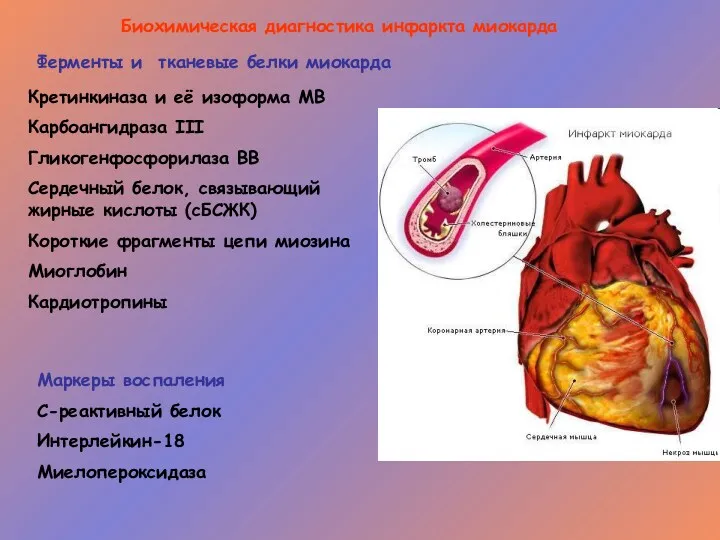Биохимическая диагностика инфаркта миокарда Кретинкиназа и её изоформа МВ Карбоангидраза