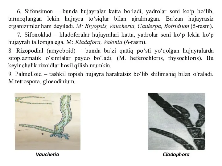 6. Sifonsimon – bunda hujayralar katta bo‘ladi, yadrolar soni ko‘p