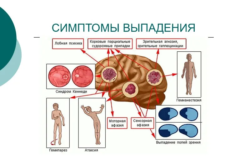 СИМПТОМЫ ВЫПАДЕНИЯ