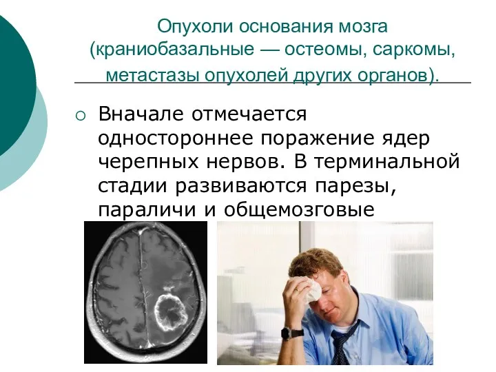 Опухоли основания мозга (краниобазальные — остеомы, саркомы, метастазы опухолей других органов). Вначале отмечается