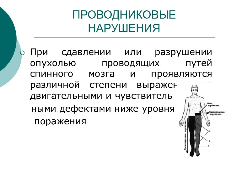 ПРОВОДНИКОВЫЕ НАРУШЕНИЯ При сдавлении или разрушении опухолью проводящих путей спинного мозга и проявляются