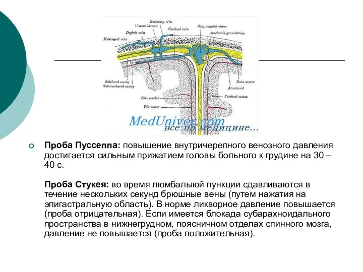 Проба Пуссеппа: повышение внутричерепного венозного давления достигается сильным прижатием головы больного к грудине