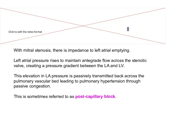 With mitral stenosis, there is impedance to left atrial emptying. Left atrial pressure