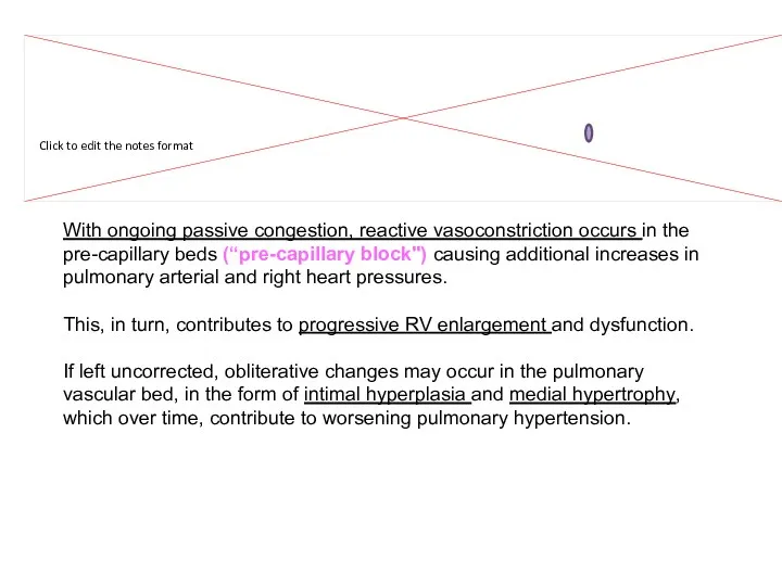 With ongoing passive congestion, reactive vasoconstriction occurs in the pre-capillary beds (“pre-capillary block")