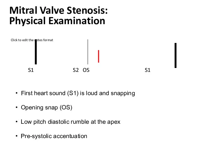 S1 S2 OS S1 First heart sound (S1) is loud and snapping Opening