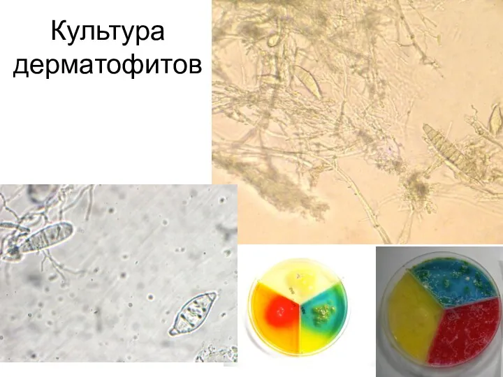 Культура дерматофитов