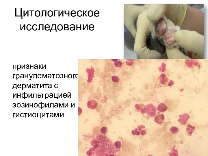 Цитологическое исследование признаки гранулематозного дерматита с инфильтрацией эозинофилами и гистиоцитами