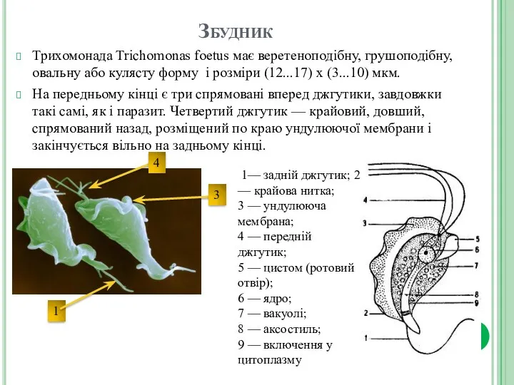 Збудник Трихомонада Trichomonas foetus має веретеноподібну, грушоподібну, овальну або кулясту