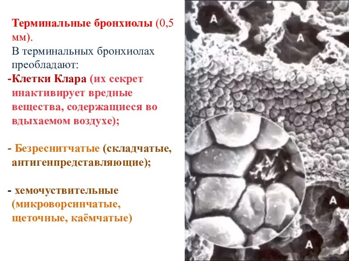 Терминальные бронхиолы (0,5 мм). В терминальных бронхиолах преобладают: Клетки Клара