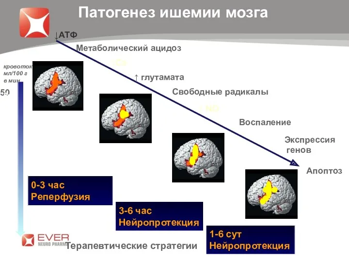 Патогенез ишемии мозга ↓АТФ Метаболический ацидоз ↑Ca ↑ глутамата Свободные радикалы ↑ NO