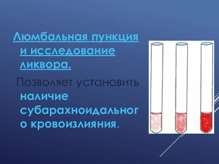 Люмбальная пункция и исследование ликвора. Позволяет установить наличие субарахноидального кровоизлияния.