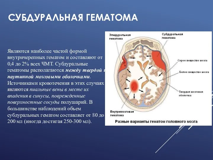 СУБДУРАЛЬНАЯ ГЕМАТОМА Являются наиболее частой формой внутричерепных гематом и составляют