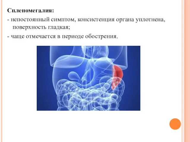 Спленомегалия: - непостоянный симптом, консистенция органа уплотнена, поверхность гладкая; - чаще отмечается в периоде обострения.