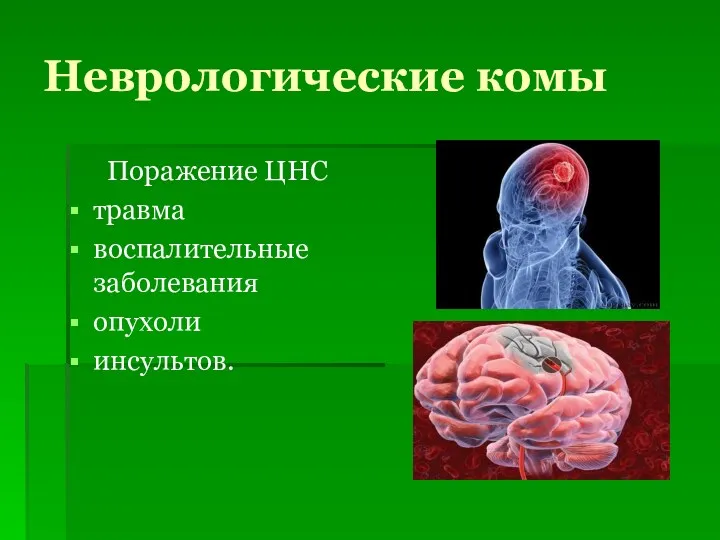 Неврологические комы Поражение ЦНС травма воспалительные заболевания опухоли инсультов.