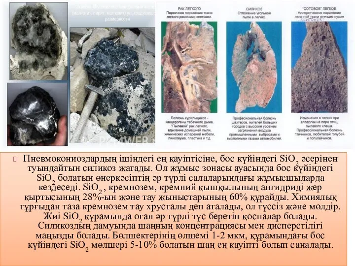 Пневмокониоздардың ішіндегі ең қауіптісіне, бос күйіндегі SiO2 әсерінен туындайтын силикоз