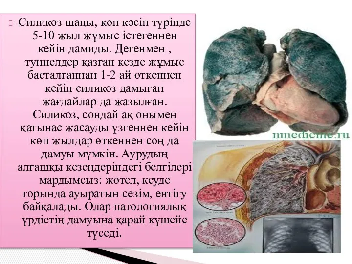 Силикоз шаңы, көп кәсіп түрінде 5-10 жыл жұмыс істегеннен кейін