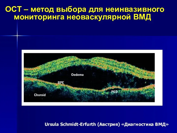 OCT – метод выбора для неинвазивного мониторинга неоваскулярной ВМД Ursula Schmidt-Erfurth (Австрия) «Диагностика ВМД»