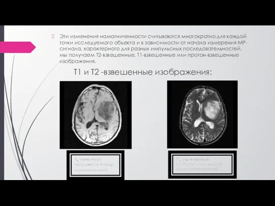 Эти изменения намагниченности считываются многократно для каждой точки исследуемого объекта