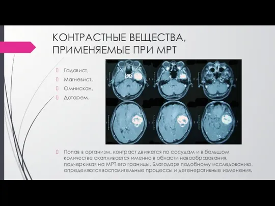 КОНТРАСТНЫЕ ВЕЩЕСТВА, ПРИМЕНЯЕМЫЕ ПРИ МРТ Гадовист, Магневист, Омнискан, Дотарем. Попав