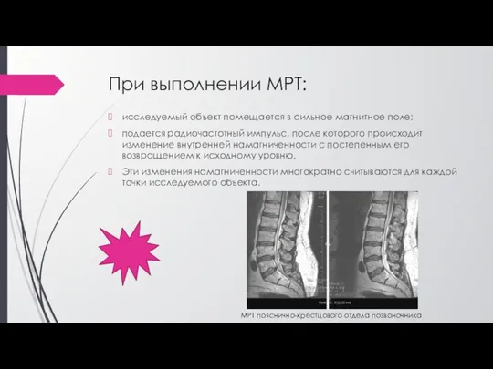 При выполнении МРТ: исследуемый объект помещается в сильное магнитное поле;