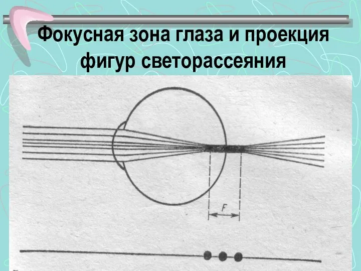 Фокусная зона глаза и проекция фигур светорассеяния