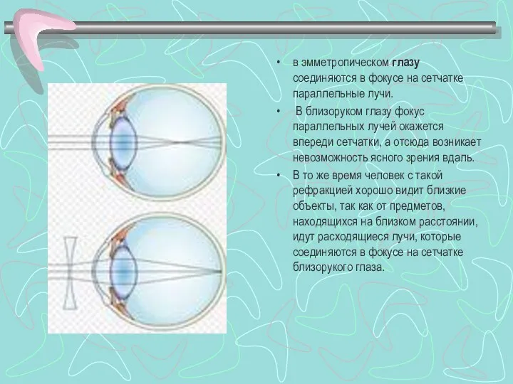 в эмметропическом глазу соединяются в фокусе на сетчатке параллельные лучи. В близоруком глазу