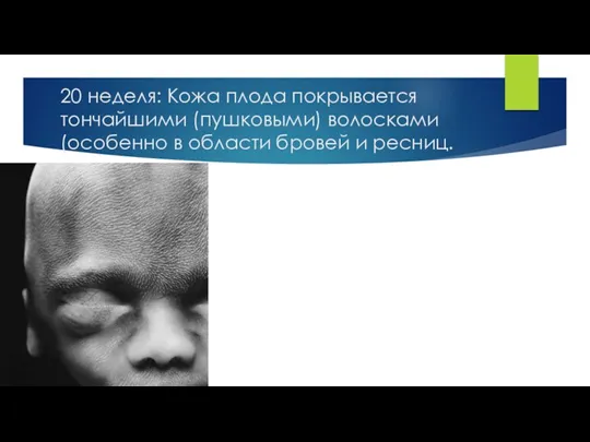 20 неделя: Кожа плода покрывается тончайшими (пушковыми) волосками (особенно в области бровей и ресниц.