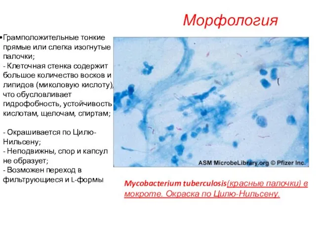 Морфология Mycobacterium tuberculosis(красные палочки) в мокроте. Окраска по Цилю-Нильсену. Грамположительные