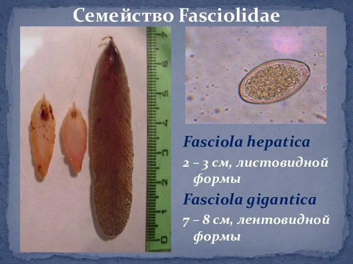 Fasciola hepatica 2 – 3 см, листовидной формы Fasciola gigantica