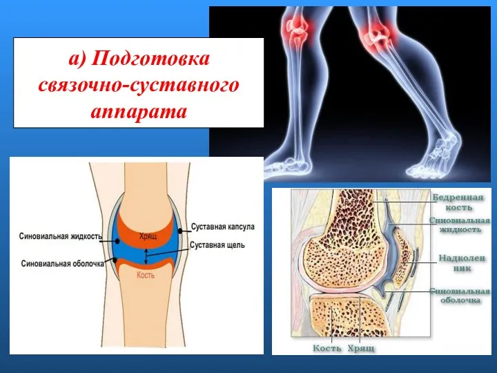а) Подготовка связочно-суставного аппарата