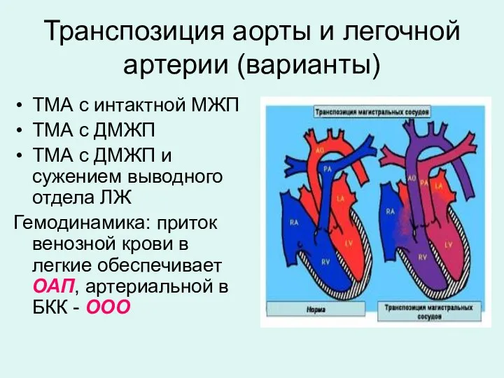 Транспозиция аорты и легочной артерии (варианты) ТМА с интактной МЖП