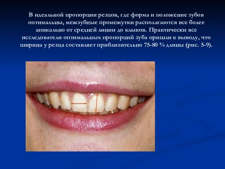 В идеальной пропорции резцов, где форма и положение зубов оптимальны,