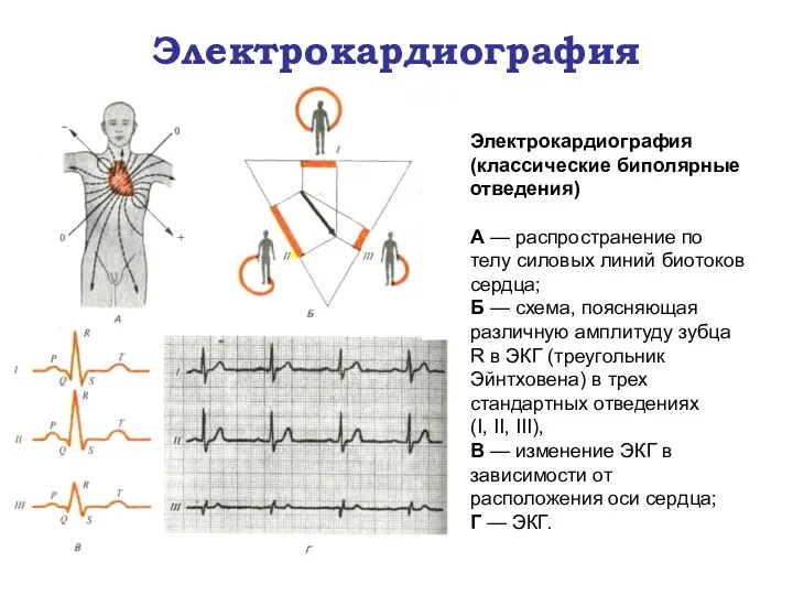 Электрокардиография (классические биполярные отведения) А — распространение по телу силовых