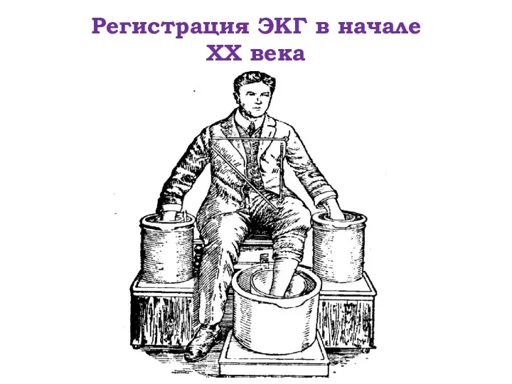 Регистрация ЭКГ в начале XX века