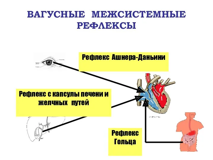 ВАГУСНЫЕ МЕЖСИСТЕМНЫЕ РЕФЛЕКСЫ Рефлекс Ашнера-Даньини Рефлекс с капсулы печени и желчных путей Рефлекс Гольца